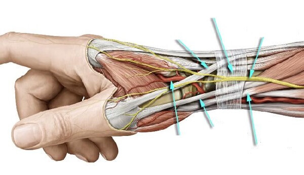 Photo of Đá Muối Hồng Có Trị Hết Bệnh Viêm Bao Gân Tay Chân Không?