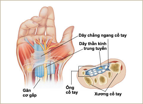 Tê Tay Báo Hiệu Sớm Của Các Bệnh Nguy Hiểm Nào