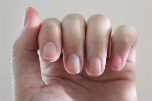 Photo of Chứng Tê Nhức Đầu Ngón Tay – Có Trị Được Không?