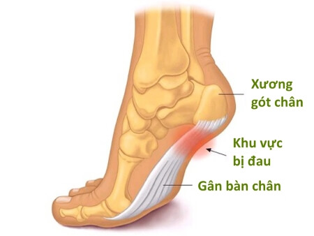 Ảnh của 