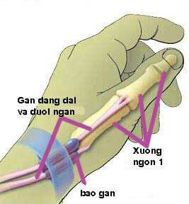 Các thông tin cụ thể về bệnh viêm bao da vùng mõm trâm quay