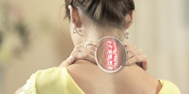 Vẹo đốt sống cổ: Trị ngay trước khi tạo ra hệ lụy