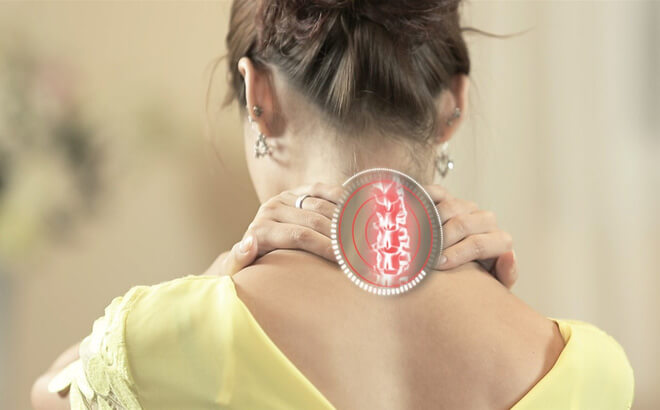 Photo of Vẹo đốt sống cổ: Trị ngay trước khi tạo ra hệ lụy