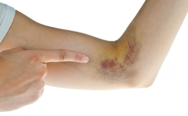 Liệt kê danh sách các biểu hiện của da phản ánh tình trạng sức khỏe