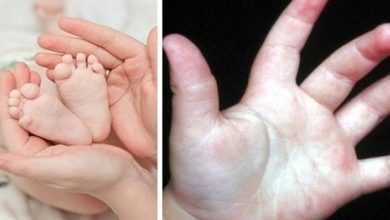 Photo of 4 Cách Điều Trị Bệnh Ra Mồi Hôi Tay Chân Cho Trẻ Em