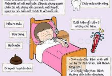 Photo of Nguyên Nhân Sốt Xuất Huyết Ở Trẻ Em Và 7 Cách Phòng Hiệu Quả