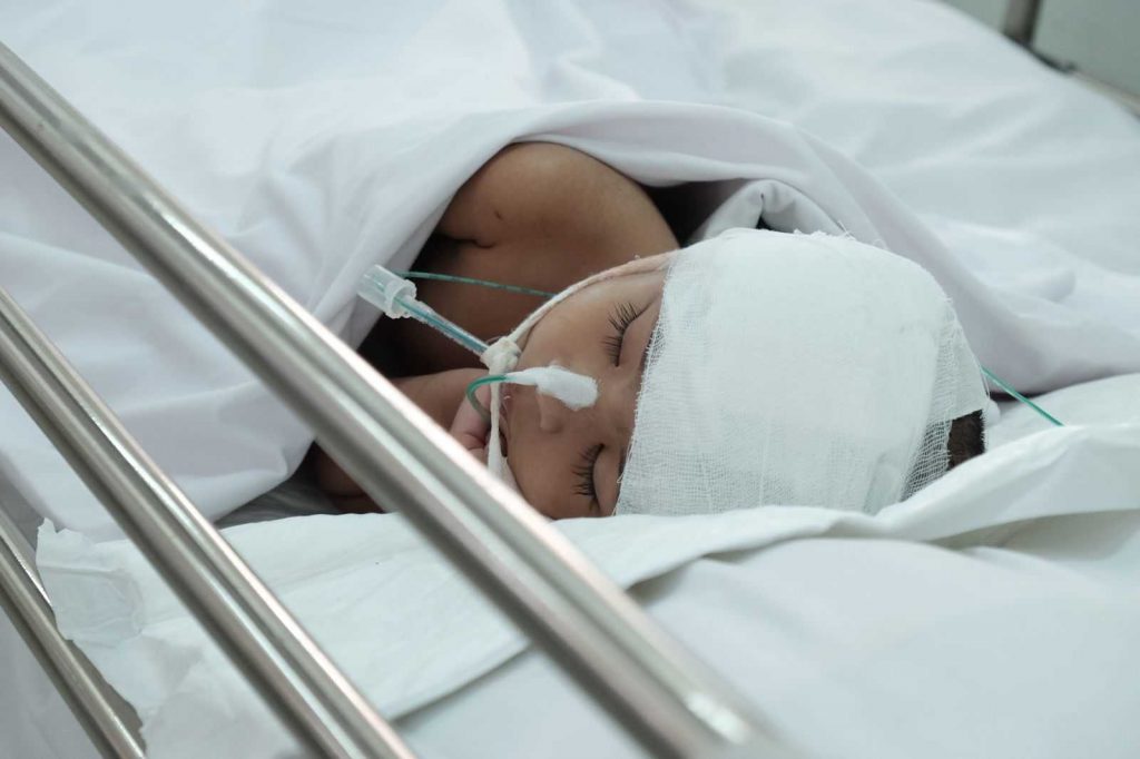 cập nhật nhiều nhất về chấn thương sọ não ở trẻ em