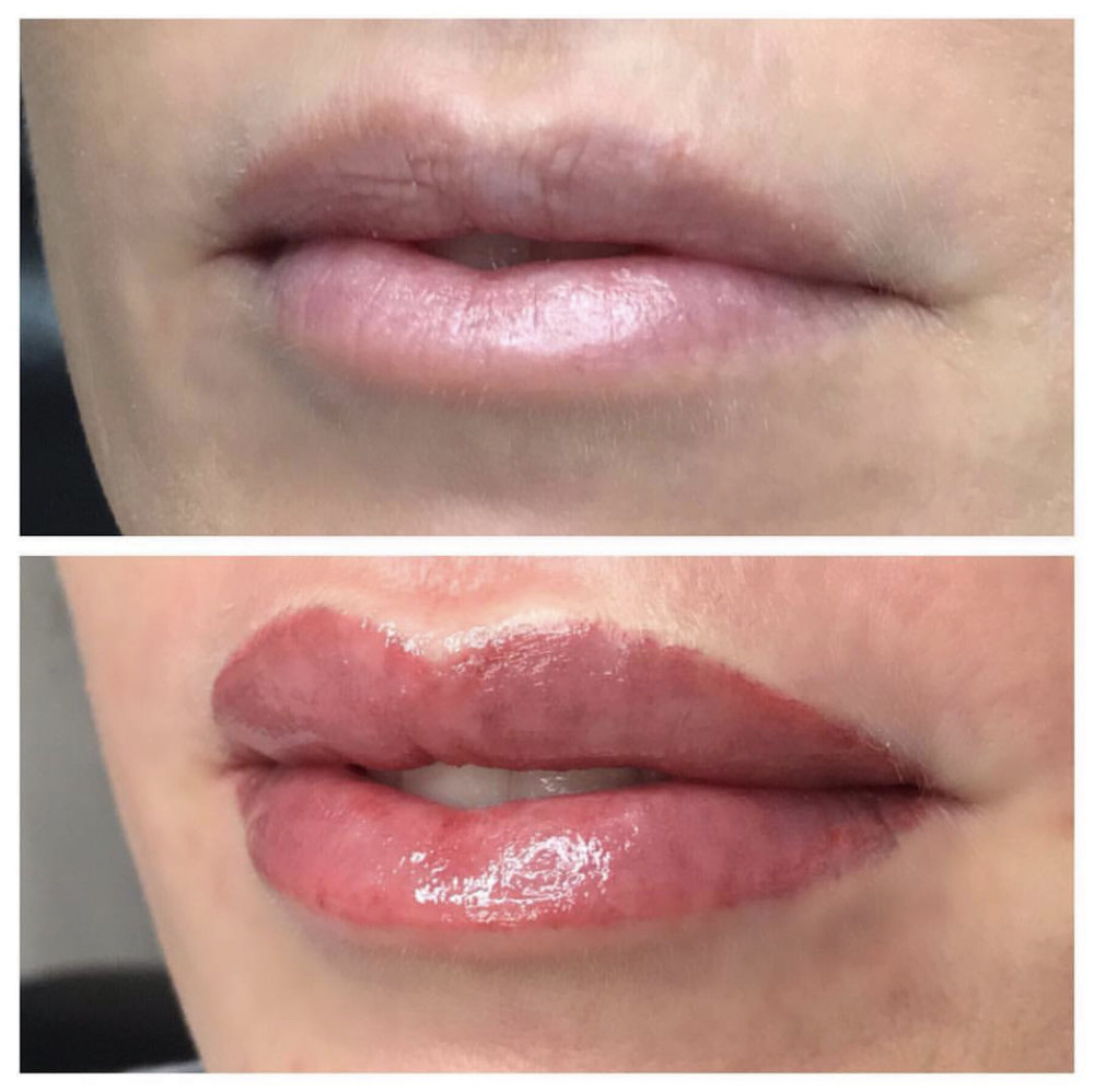 Phun Môi Collagen ở đâu uy tín nhất