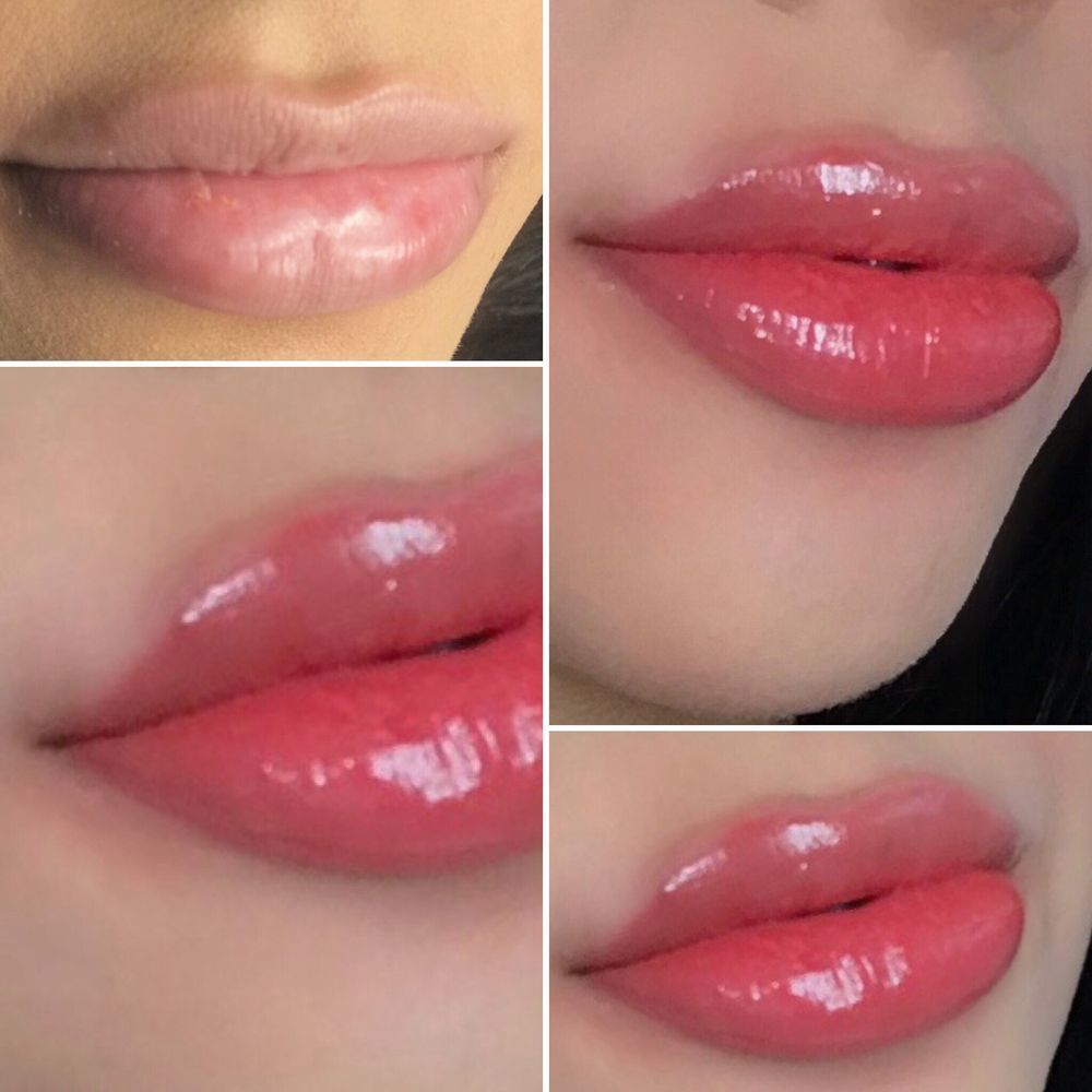 Địa chỉ Phun Môi Collagen tại tphcm