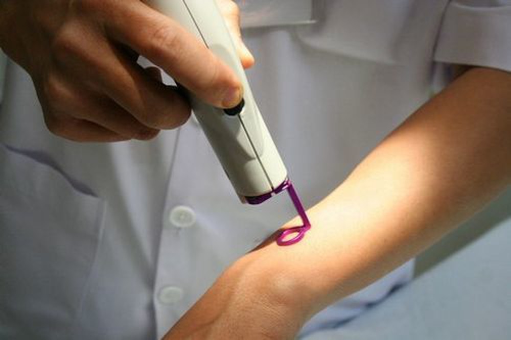 The 3 Most Common Treatments About Hemangioma in Children 3 2020