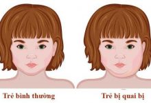 Ảnh của 