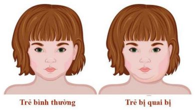Ảnh của 
